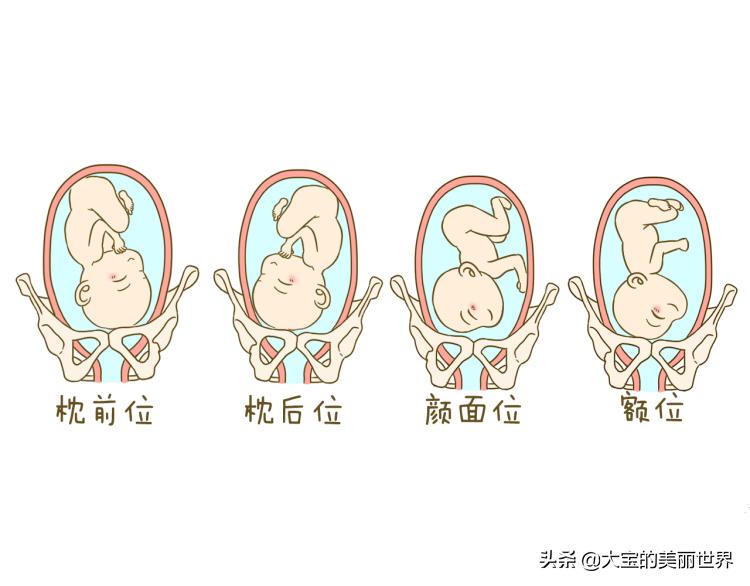 39周胎位不正能转过来吗,孕期胎位不正准妈妈莫慌张