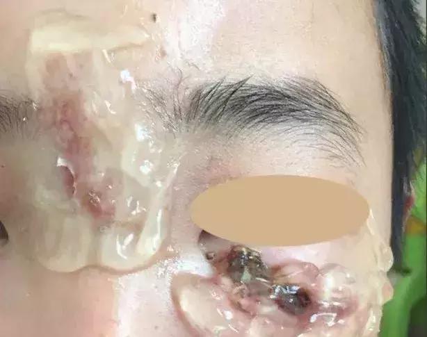 万能天然芦荟胶,一款被称为万能胶的完美芦荟胶