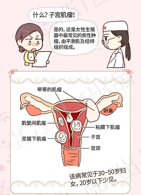 妇科大夫治疗子宫肌瘤的方法,妇科医院治疗子宫肌瘤怎么样