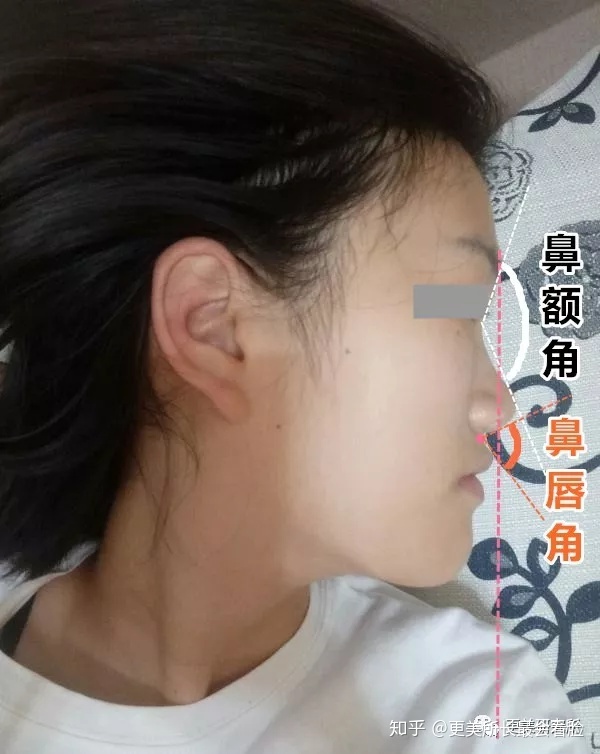 好看的侧脸要符合哪些条件,好看的侧脸的标准