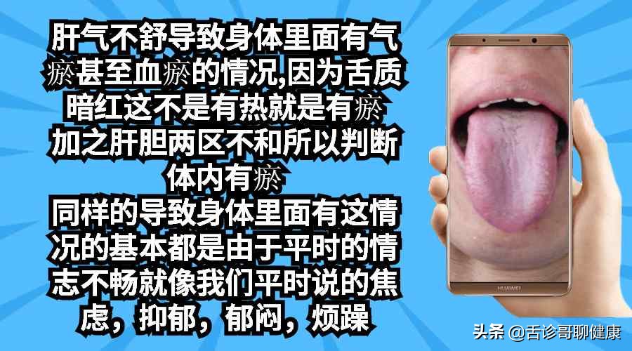 舌诊哥聊健康调脾胃,舌诊哥聊健康
