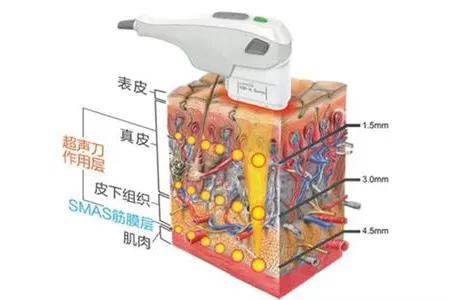 打完玻尿酸和瘦脸针的注意事项,打完玻尿酸和瘦脸针应该注意什么