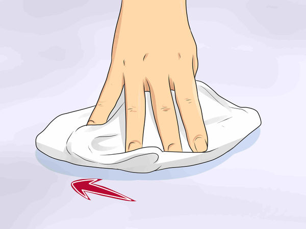 鏈夋満鐜荤拑鍒掔棔淇,鐜荤拑鍒掔棔淇浠锋牸