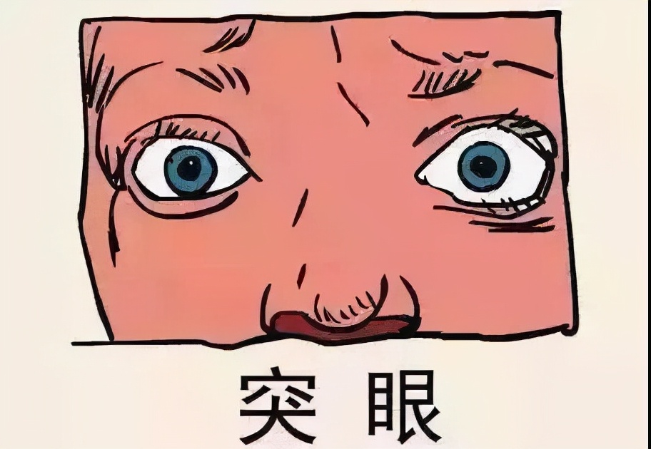 甲亢感觉眼睛有一点点突算严重吗,甲亢从刚突眼到严重需要多长时间