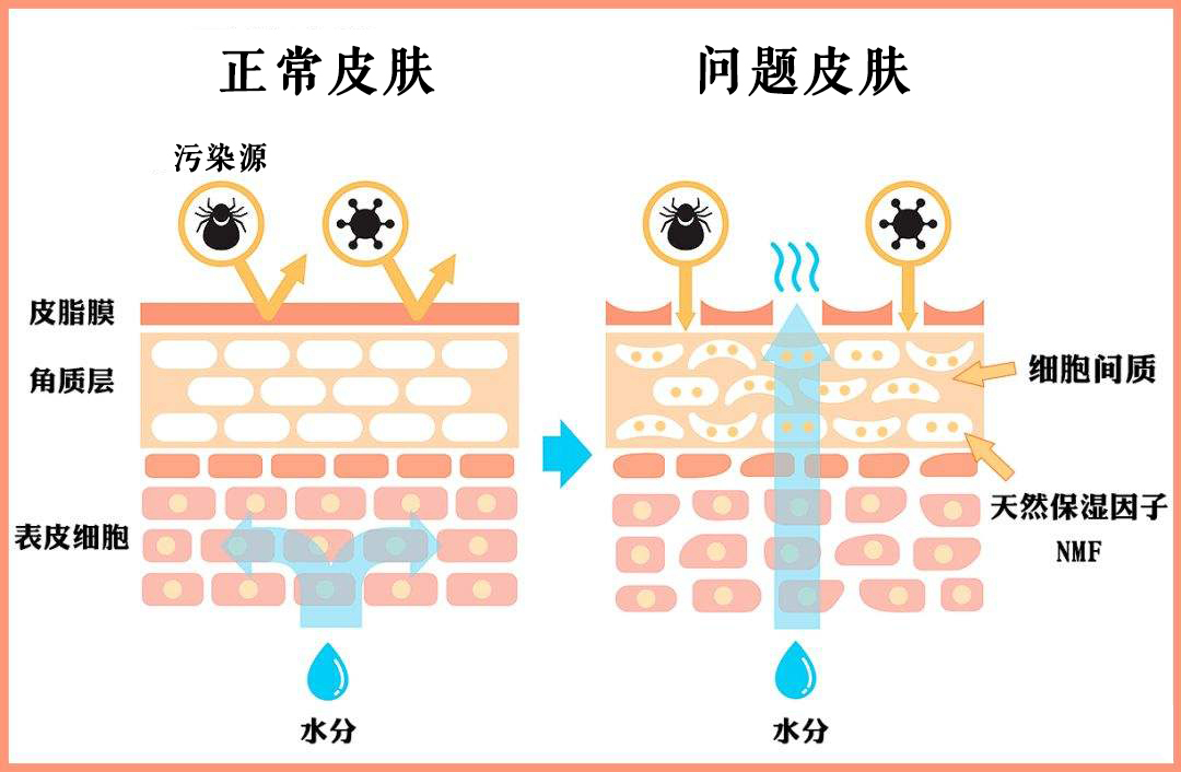 大宝sod蜜可以修复皮肤屏障受损吗,屏障受损抵抗力差怎么办