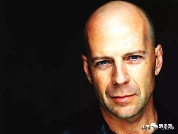 脱发真的是“无药可救”吗？其实是“有药可救”的