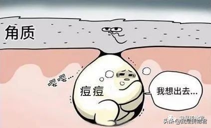 痘痘肌用什么医美面膜,医美面膜测评痘痘肌