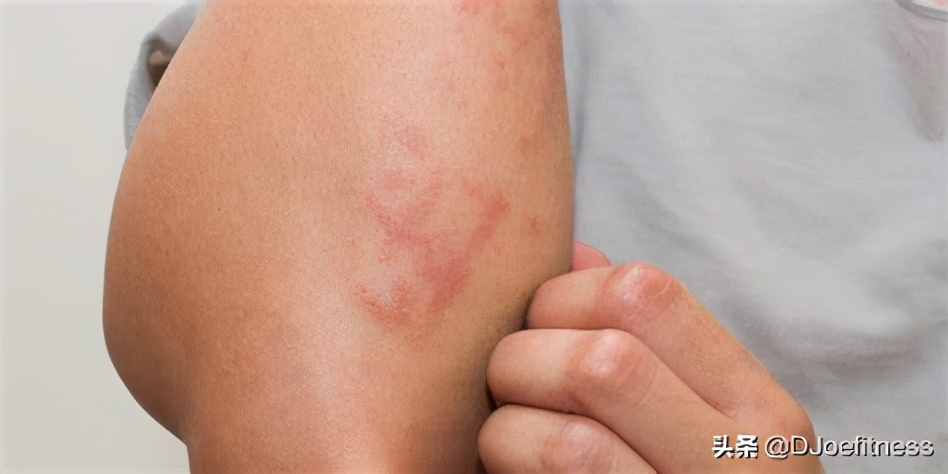 减肥后的皮肤松弛怎么解决,减肥后松弛的皮肤怎么变紧致