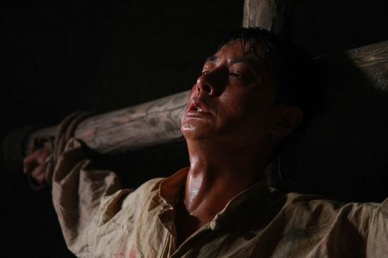 做手术时血是怎样止住,医生在做手术时如何止血