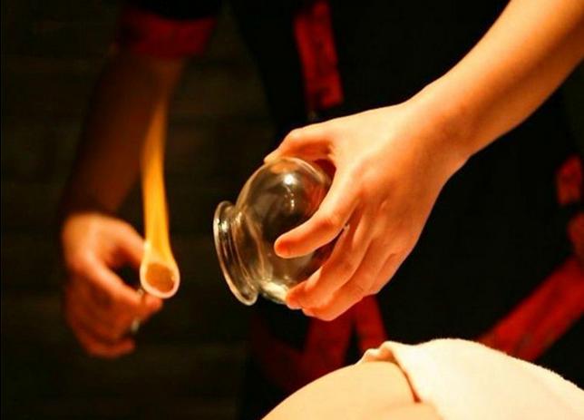 中医拔火罐治疱疹视频,中医拔火罐操作视频