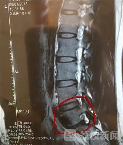 婴儿背带腰凳好还是不带腰凳好,腰凳和背带哪个对宝宝比较舒适