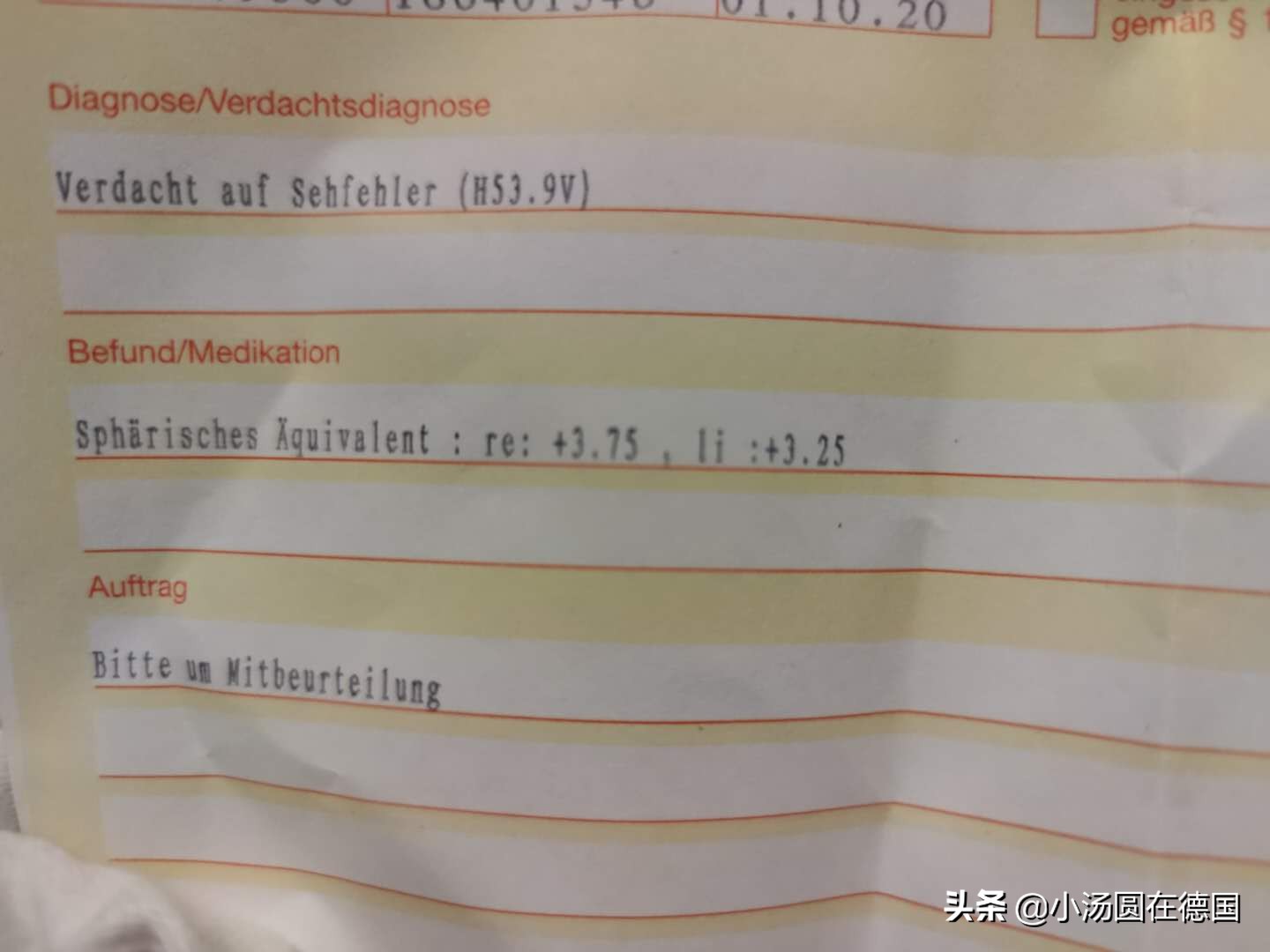 弱视检查，6月龄宝宝就可做，千万别忽视3岁前干预的关键期