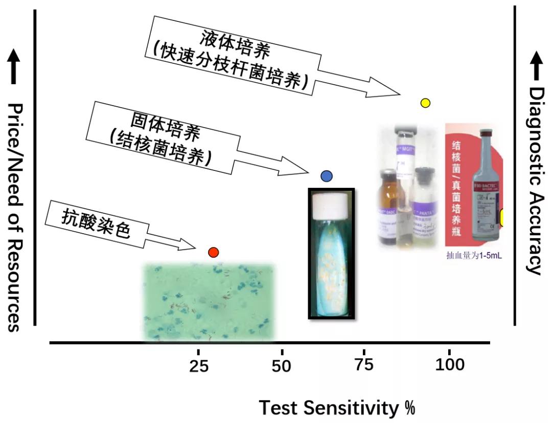 结核诊断方法和防治原则,结核的病原学诊断