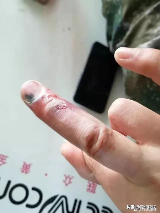 疫情我们能熬过去吗 (疫情期间你熬得住吗)