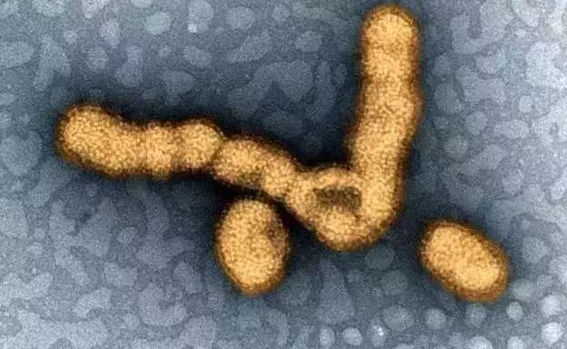 日本疫情暴发,日本爆发大规模疫情