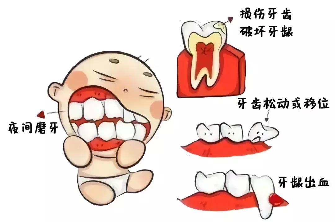 一岁半宝宝磨牙咯吱响怎么回事,宝宝睡觉磨牙厉害是怎么回事