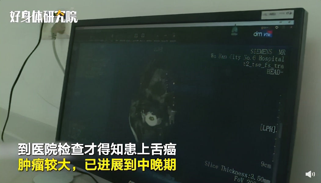 口腔溃疡长时间不好一定是舌癌吗,几乎每天都有口腔溃疡是舌癌吗