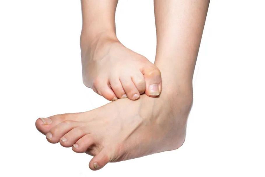 天气一热脚就脚臭?教你5招,远离脚气