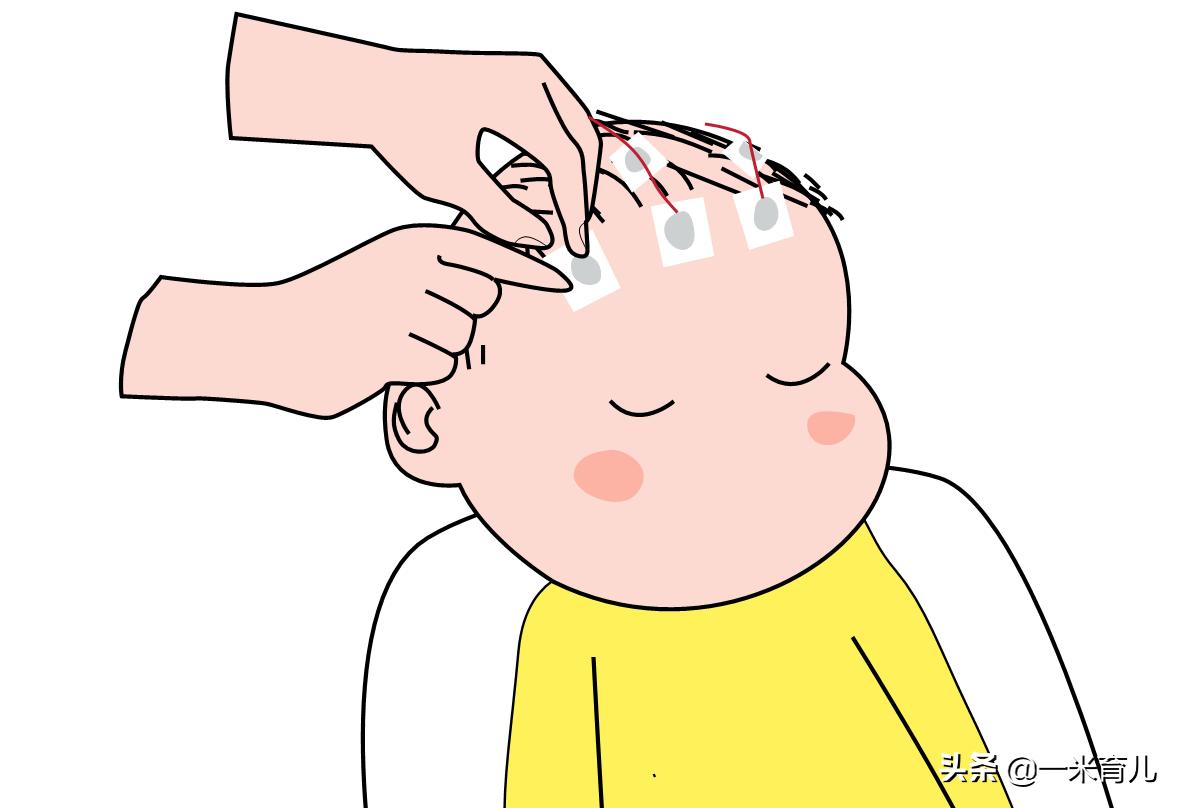 小儿癫痫莫要怕，规律服药、做好居家护理8要点，成长上学两不误