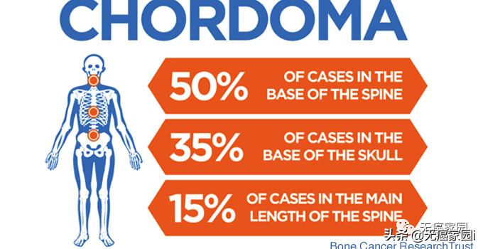质子治疗手术适合大型肿瘤,肿瘤不能根治吗