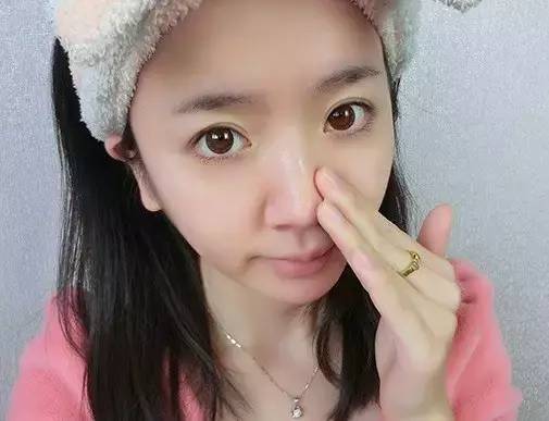 毛孔粗大、鼻子起皮是怎么引起的呢？日常护肤小常识帮你解决