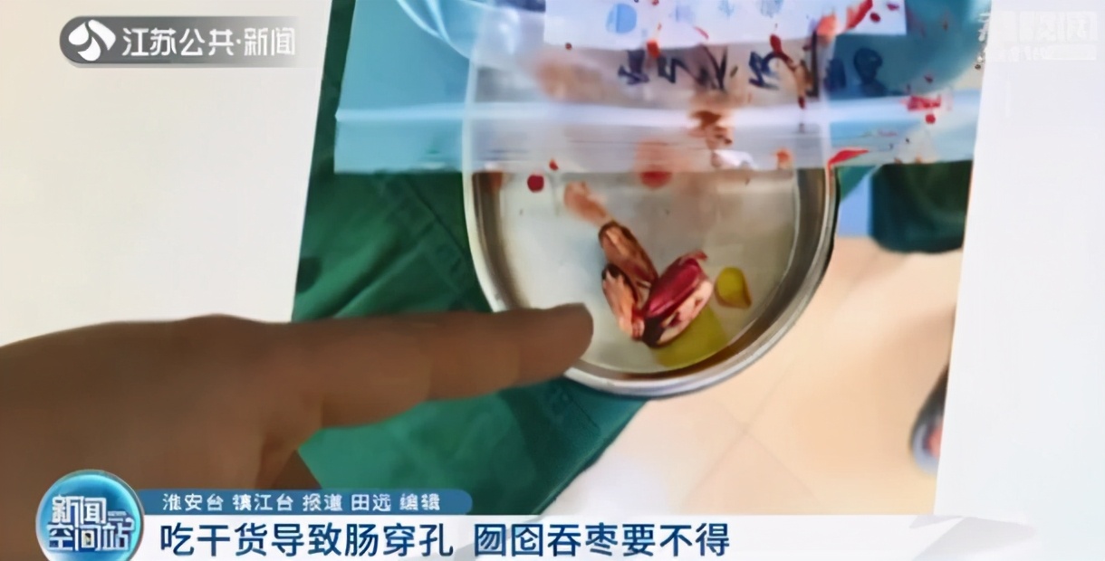 吃坚果类拉肚子,吃坚果会闹肚子吗