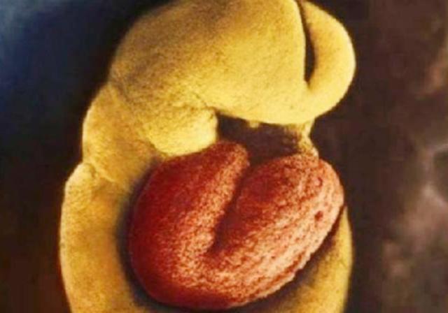 组图*放播**精子和卵子结合全过程，精子：找个媳妇，太难了