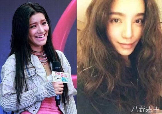 各届超女整容,2015年超女整容失败新闻案例