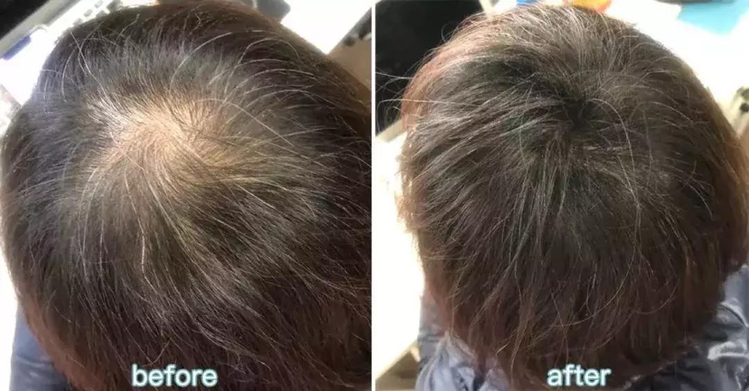 金晨：我们来自拍吧，张歆艺：先分我点头发...