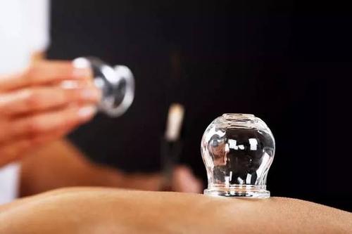 拔罐或针灸能治白癜风,白癜风拔罐