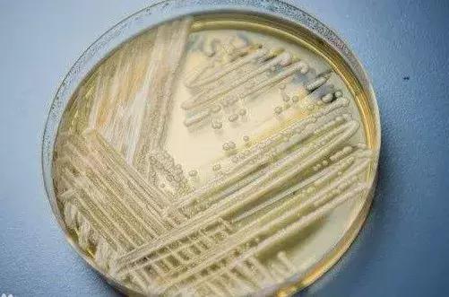 可怕的真菌有哪些,究竟如何杀死真菌