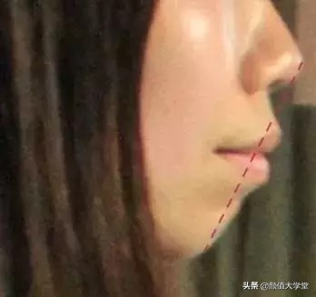 下巴后缩怎么拍侧颜,下巴后缩需要怎么矫正