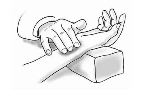 中医对肛瘘的保守治疗方法,肛瘘从中医来讲是什么原因造成的