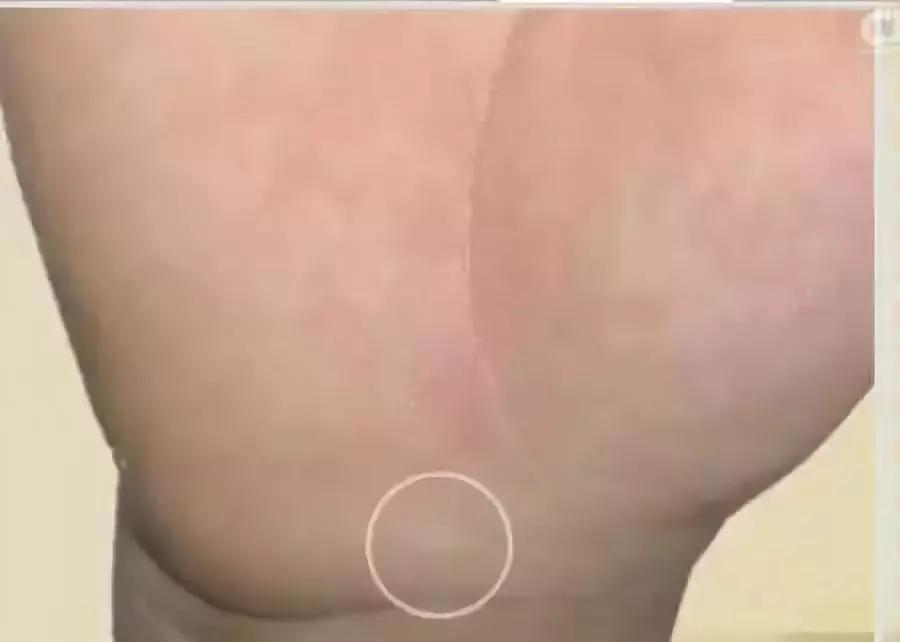 手健康有多重要,手型看健康