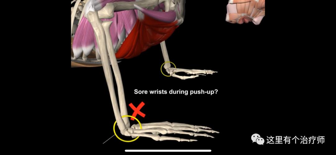 【运动损伤Respond】第一期，俯卧撑与肘关节疼痛。