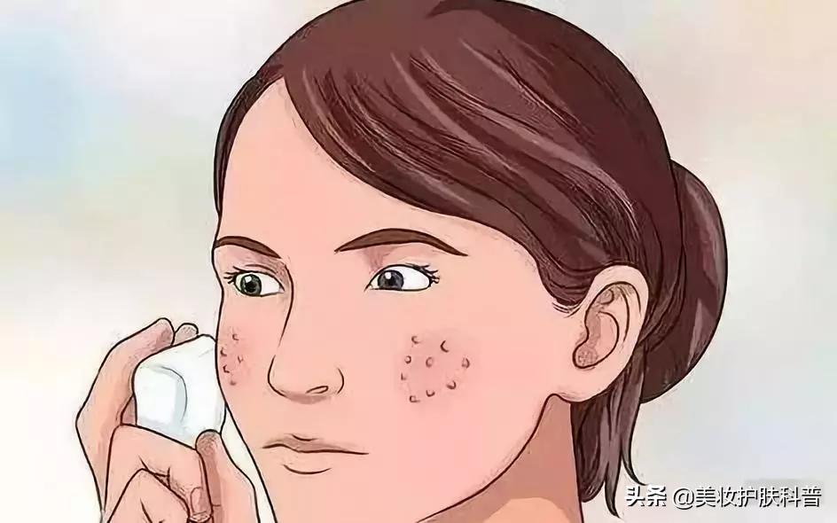 毛孔粗大怎么办最有效收缩毛孔,毛孔粗大收缩毛孔最快有效的方法