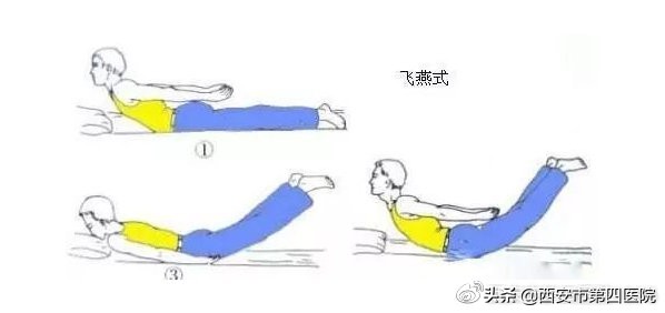 椎间盘突出压迫神经怎么治,为什么会有椎间盘突出