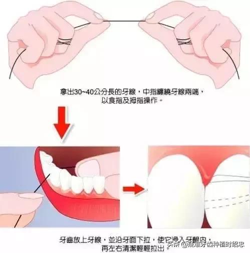 如何预防和治疗牙周炎,矫正完怎么预防牙周炎