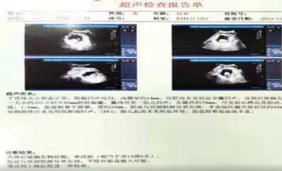 怀孕40-50天孕囊内是空的怎么回事,怀孕40天检查孕囊空