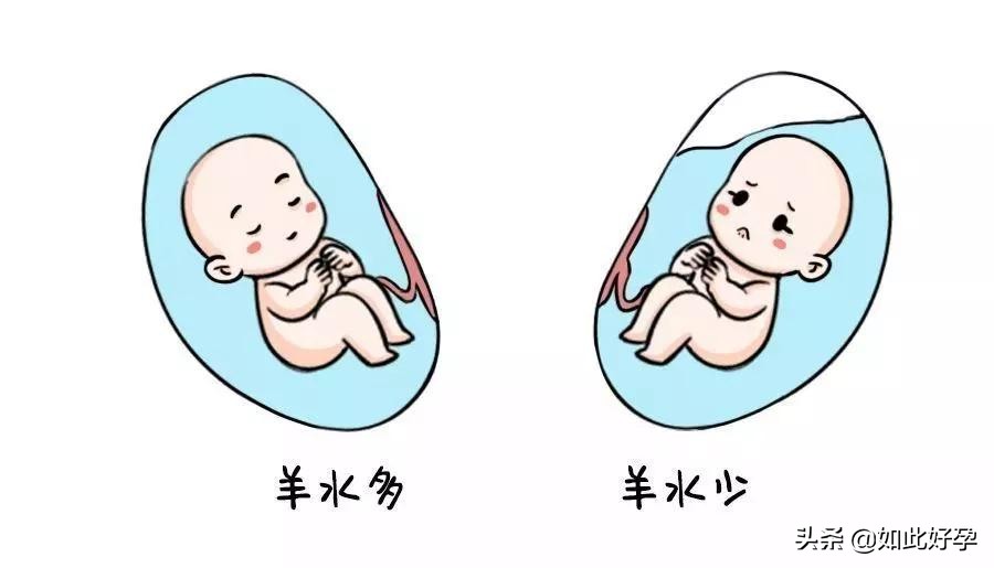 孕妈有这些表现，很可能是羊水出现大问题，要立刻去医院