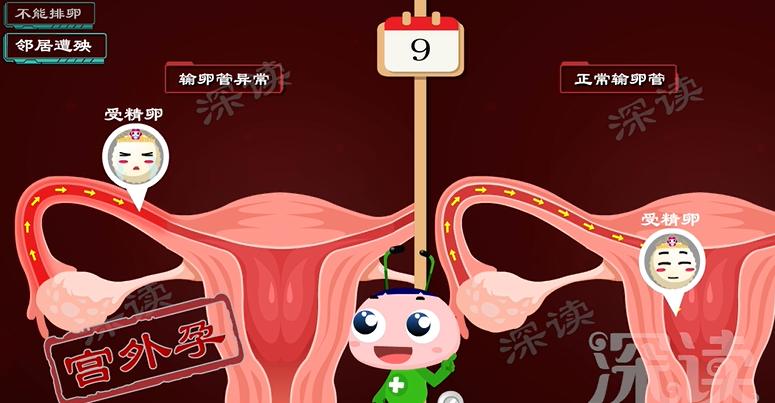 月经不调？怀孕困难？会搞出宫外孕？盆腔炎危害有多大？硬核科普