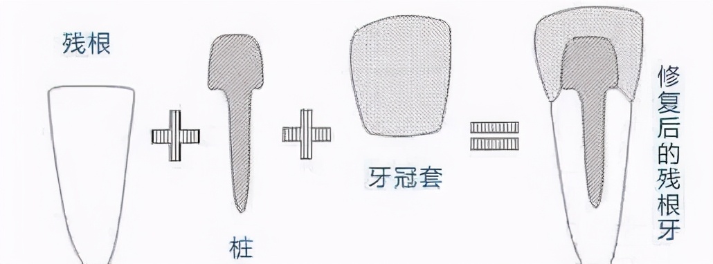 女子吃饭牙掉了原视频,吃骨头大牙崩掉一块