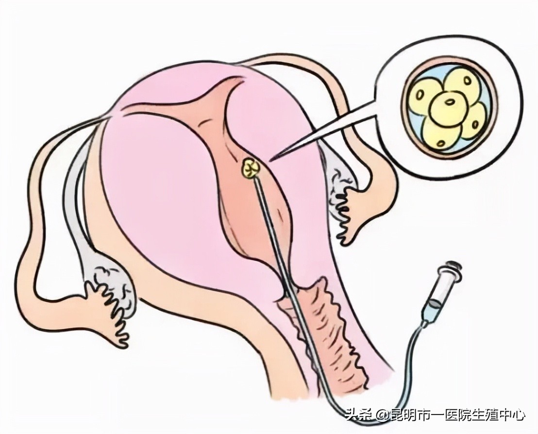 试管小白——“顶流”级别的胚胎长啥样？