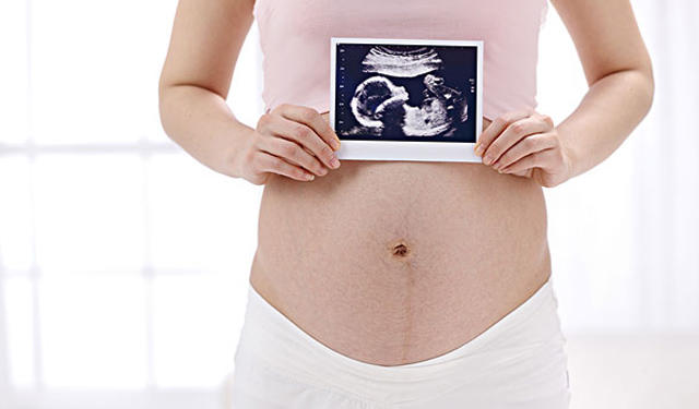 四维彩超很难预约,查四维胎儿不配合咋办