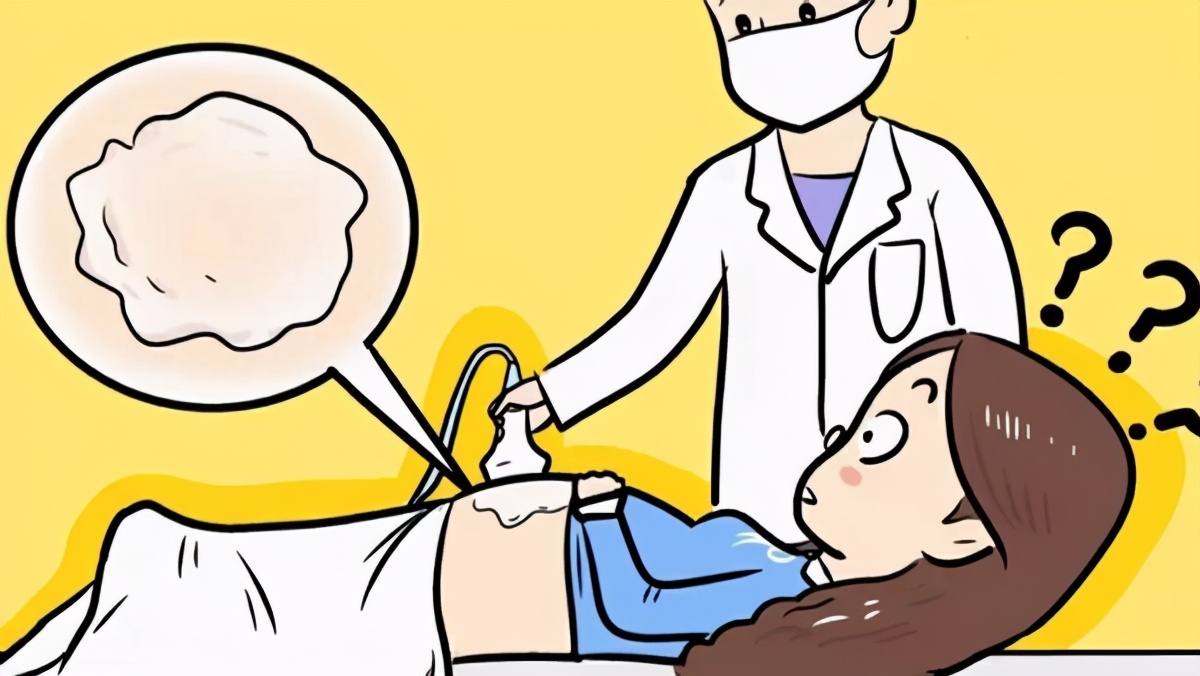 体检仪器大科普,健康体检b超