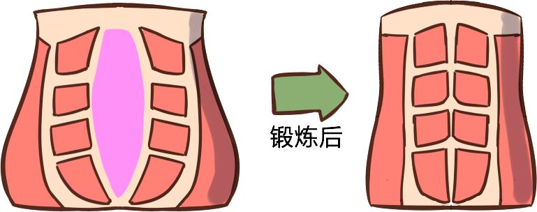 产后盆底功能障碍要做康复治疗吗,盆底功能障碍严重者需要治疗吗