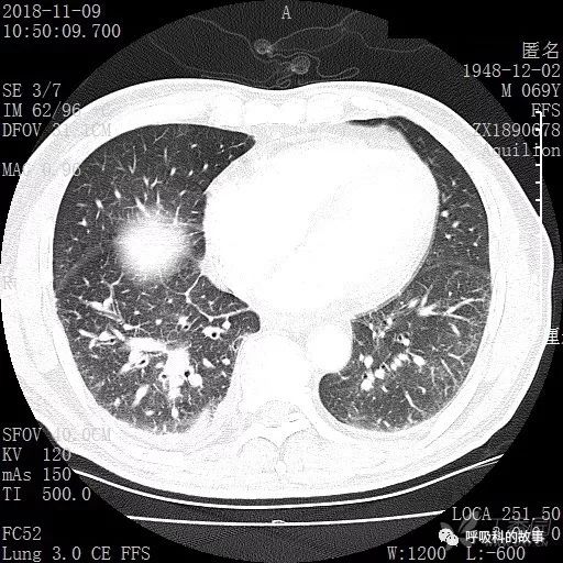 怎么应用统计学做调查,统计学方法可以解决的主要问题