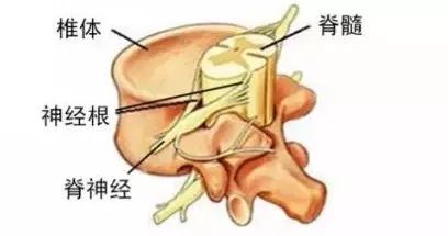 腰椎间盘突出坐骨神经痛如何缓解,腰椎间盘突出脚痛神经痛怎么缓解