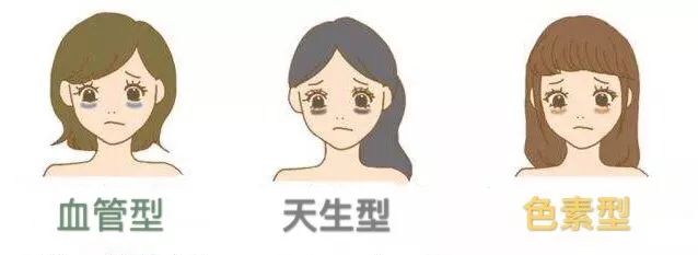 眼霜越贵去黑眼圈效果越好,眼霜哪款才是真正有效好用的