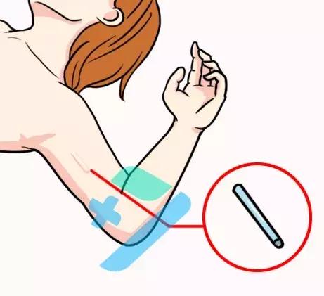 避孕几率高达99%,避孕成功率百分之一百